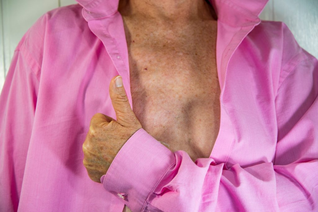 Breast Cancer Rehab